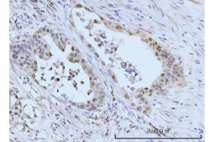 IHC analysis of SBNO1 using anti-SBNO1 antibody (ABIN7601710). (SBNO1 抗体  (AA 43-1303))
