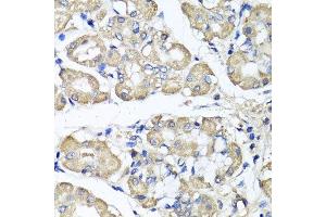 Immunohistochemistry of paraffin-embedded human stomach using BCS1L antibody. (BCS1L 抗体  (AA 33-240))