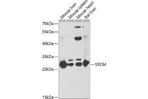 Western blot analysis of extracts of various cell lines, using STOM antibody (ABIN6132877, ABIN6148626, ABIN6148628 and ABIN6221992) at 1:1000 dilution. (Stomatin 抗体  (AA 55-288))