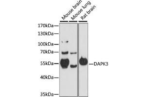Western blot analysis of extracts of various cell lines, using D antibody (ABIN7266712) at 1:1000 dilution. (DAPK3 抗体  (AA 1-100))