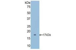 Western blot analysis of recombinant Rat CUBN. (CUBN 抗体  (AA 3157-3274))