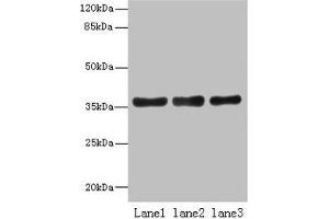 Western blot All lanes: UPP2 antibody at 4 μg/mL Lane 1: Mouse kidney tissue Lane 2: Mouse brain tissue Lane 3: Hela whole cell lysate Secondary Goat polyclonal to rabbit IgG at 1/10000 dilution Predicted band size: 36, 42 kDa Observed band size: 36 kDa (UPP2 抗体  (AA 1-317))