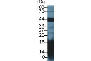 Western Blot; Sample: Mouse Pancreas lysate; Primary Ab: 2µg/ml Rabbit Anti-Rat REG1a Antibody Second Ab: 0. (REG1A 抗体  (AA 22-165))
