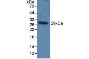 Detection of Recombinant TLR5, Human using Polyclonal Antibody to Toll Like Receptor 5 (TLR5) (TLR5 抗体  (AA 303-514))