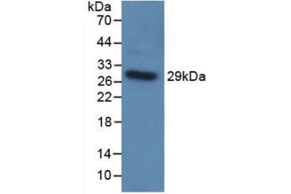 TLR5 Antikörper  (AA 303-514)
