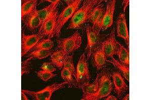 IF analysis of ALKBH1 using anti-ALKBH1 antibody (ABIN7602742) and anti-Tubulin Alpha antibody (ABIN7600339).