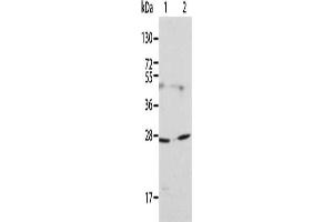 Gel: 12 % SDS-PAGE, Lysate: 40 μg, Lane 1-2: 231 cells, HT29 cells, Primary antibody: ABIN7130018(KLK15 Antibody) at dilution 1/200, Secondary antibody: Goat anti rabbit IgG at 1/8000 dilution, Exposure time: 1 minute (Kallikrein 15 抗体)