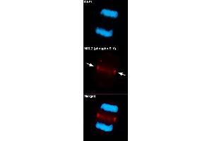 Immunofluorescent staining of methanol-fixed U87 cells using MYL2 (phospho S15) polyclonal antibody  at 1:100-1:200 dilution. (MYL2 抗体  (pSer15))