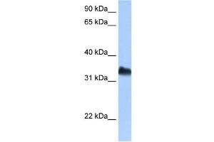 DND1 antibody used at 0. (DND1 抗体)
