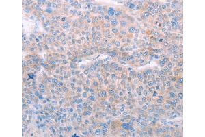 Immunohistochemistry (IHC) image for anti-Spermatogenesis Associated 6 (SPATA6) antibody (ABIN2422311) (SPATA6 抗体)