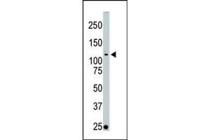 The anti-LOK Pab (ABIN392476 and ABIN2842057) is used in Western blot to detect LOK in Jurkat cell lysate. (STK10-A 抗体  (C-Term))