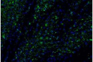 Image no. 2 for anti-Chemokine (C-C Motif) Ligand 2 (CCL2) antibody (ABIN465001) (CCL2 抗体)