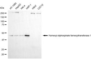 Western blotting analysis using farnesyl-diphosphate farnesyltransferase 1 antibody (ABIN7798571). (FDFT1 抗体)