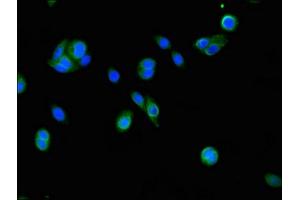 Immunofluorescent analysis of HepG2 cells using ABIN7152911 at dilution of 1:100 and Alexa Fluor 488-congugated AffiniPure Goat Anti-Rabbit IgG(H+L) (FSIP2 抗体  (AA 5530-5824))