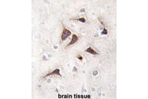 Immunohistochemistry (IHC) image for anti-Calcium/calmodulin-Dependent Protein Kinase II delta (CAMK2D) antibody (ABIN5023065) (CAMK2D 抗体)