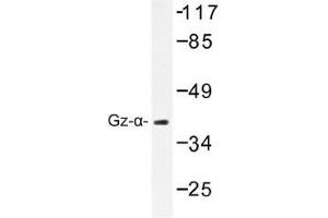 Image no. 1 for anti-Guanine Nucleotide Binding Protein (G Protein), alpha Z Polypeptide (GNaZ) antibody (ABIN317793) (GNaZ 抗体)
