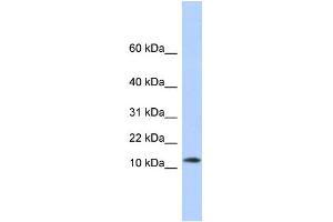 WB Suggested Anti-MAP1LC3A Antibody Titration:  0. (MAP1LC3A 抗体  (N-Term))