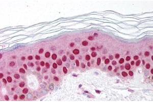 Human Skin (formalin-fixed, paraffin-embedded) stained with GDF9 antibody ABIN214650 at 10 ug/ml followed by biotinylated goat anti-rabbit IgG secondary antibody ABIN481713, alkaline phosphatase-streptavidin and chromogen. (GDF9 抗体  (AA 45-59))