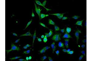 Image provided by One World Lab validation program. (Cathepsin L 抗体  (AA 71-170))