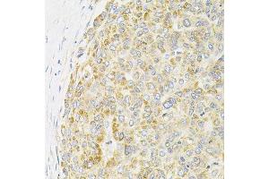 Immunohistochemistry (Paraffin-embedded Sections) (IHC (p)) image for anti-Protein Phosphatase 1, Catalytic Subunit, alpha Isoform (PPP1CA) (AA 1-330) antibody (ABIN6146053)