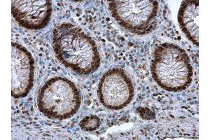 Immunohistochemistry (IHC) image for anti-Proliferating Cell Nuclear Antigen (PCNA) antibody (ABIN2854788)