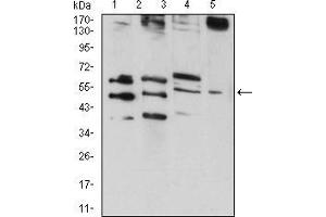 Western blot analysis using RAD52 mouse mAb against HepG2 (1), MCF-7 (2), MCF-7 (3), and C6 (4) cell lysate. (RAD52 抗体  (AA 269-418))