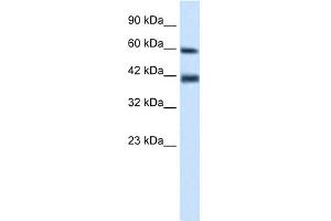 WB Suggested Anti-TRIM31 Antibody Titration:  0. (TRIM31 抗体  (N-Term))