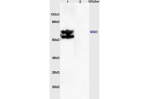 Lane 1: mouse embryo lysates Lane 2: mouse brain lysates probed with Anti PRKAG2/AMPK? (AMPK gamma 1/2/3 (AA 280-330) 抗体)