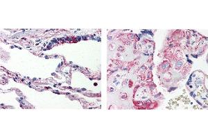 AP19004PU-N C5AR1 antibody staining of Formalin-Fixed, Paraffin-Embedded Human Lung (Left) and Human Placenta (Right) (C5AR1 抗体)