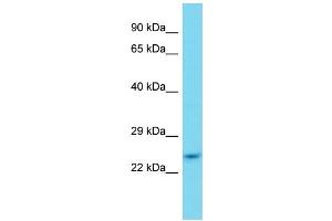 Host: Rabbit Target Name: ZFAND2B Sample Type: HepG2 Whole Cell lysates Antibody Dilution: 1.
