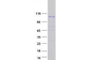 Western Blotting (WB) image for Coatomer Protein Complex, Subunit gamma 2 (COPG2) protein (Myc-DYKDDDDK Tag) (ABIN2712935)