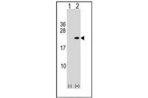 Western blot analysis of PLA2G12A (arrow) using PLA2G12A Antibody (Center) Cat. (PLA2G12A 抗体  (Middle Region))