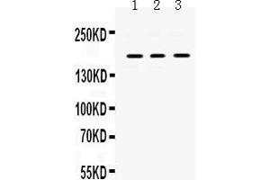 Western Blotting (WB) image for anti-Platelet Derived Growth Factor Receptor alpha (PDGFRA) (AA 968-1002), (C-Term) antibody (ABIN3043897) (PDGFRA 抗体  (C-Term))