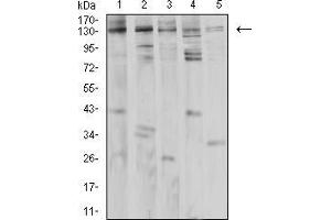 Western blot analysis using PLCG1 mouse mAb against Jurkat (1), K562 (2), A431 (3), Hela (4), and PC-12 (5) cell lysate.