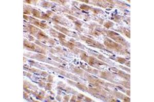 Immunohistochemistry (Paraffin-embedded Sections) (IHC (p)) image for anti-C1q and Tumor Necrosis Factor Related Protein 3 (C1QTNF3) (Intermediate Domain) antibody (ABIN499667)