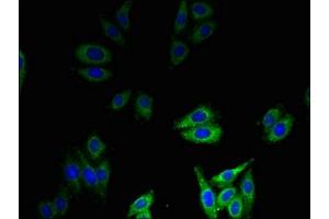 Immunofluorescent analysis of HepG2 cells using ABIN7145472 at dilution of 1:100 and Alexa Fluor 488-congugated AffiniPure Goat Anti-Rabbit IgG(H+L) (beta Defensin 1 抗体  (AA 33-68))