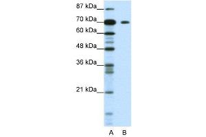WB Suggested Anti-KLHL26  Antibody Titration: 1. (KLHL26 抗体  (C-Term))