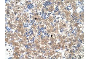 PEX3 antibody was used for immunohistochemistry at a concentration of 4-8 ug/ml. (PEX3 抗体  (N-Term))