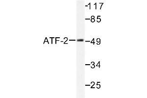 Image no. 1 for anti-Activating Transcription Factor 2 (ATF2) antibody (ABIN265321) (ATF2 抗体)
