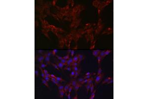 Immunofluorescence analysis of C6 cells using DUSP6 Rabbit pAb (ABIN3017520, ABIN3017521, ABIN3017522 and ABIN6220131) at dilution of 1:100 (40x lens). (DUSP6 抗体  (AA 1-170))