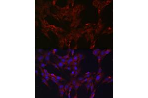 Immunofluorescence analysis of C6 cells using DUSP6 Rabbit pAb (ABIN3017520, ABIN3017521, ABIN3017522 and ABIN6220131) at dilution of 1:100 (40x lens).