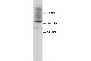 Western Blotting (WB) image for anti-Heat Shock 60kDa Protein 1 (Chaperonin) (HSPD1) antibody (ABIN1107605)