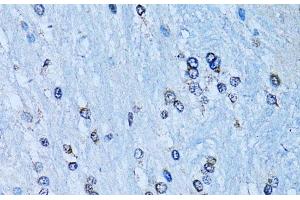 Immunohistochemistry of paraffin-embedded Rat brain using NFkB p100 / p52 Polyclonal Antibody at dilution of 1:100 (40x lens). (NFKB2 抗体)