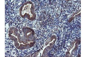 Image no. 1 for anti-Diphthamide Biosynthesis Protein 2 (DPH2) antibody (ABIN1497893) (DPH2 抗体)