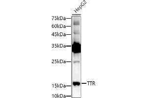 Western blot analysis of extracts of HepG2 cells, using TTR antibody (ABIN3021473, ABIN3021474, ABIN3021475 and ABIN6215107) at 1:1000 dilution. (TTR 抗体  (AA 21-147))