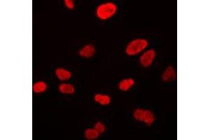 Immunofluorescent analysis of VWA5A staining in HeLa cells. (VWA5A 抗体  (Center))
