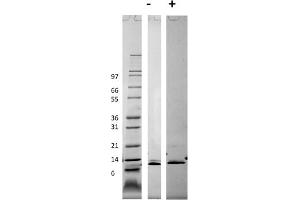 SDS-PAGE of Mouse Monocyte Chemotactic Protein-3 (CCL7) Recombinant Protein SDS-PAGE of Mouse Monocyte Chemotactic Protein-3 (CCL7) Recombinant Protein. (CCL7 蛋白)