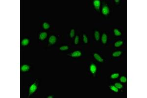 Immunofluorescent analysis of A549 cells using ABIN7150825 at dilution of 1:100 and Alexa Fluor 488-congugated AffiniPure Goat Anti-Rabbit IgG(H+L) (Dynamin 1 抗体  (AA 2-245))