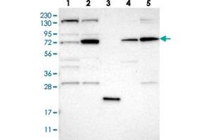 Western blot analysis of Lane 1: RT-4, Lane 2: U-251 MG, Lane 3: Human Plasma, Lane 4: Liver, Lane 5: Tonsil with DNAJC14 polyclonal antibody  at 1:250-1:500 dilution. (DNAJC14 抗体)