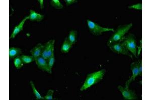 Immunofluorescent analysis of Hela cells using ABIN7163786 at dilution of 1:100 and Alexa Fluor 488-congugated AffiniPure Goat Anti-Rabbit IgG(H+L) (PAIP2 抗体  (AA 1-127))